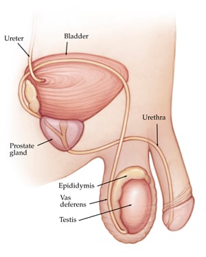 prostata inflamada y psa alto