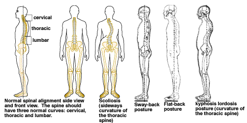 Posture for a Healthy Back | Peoples Health